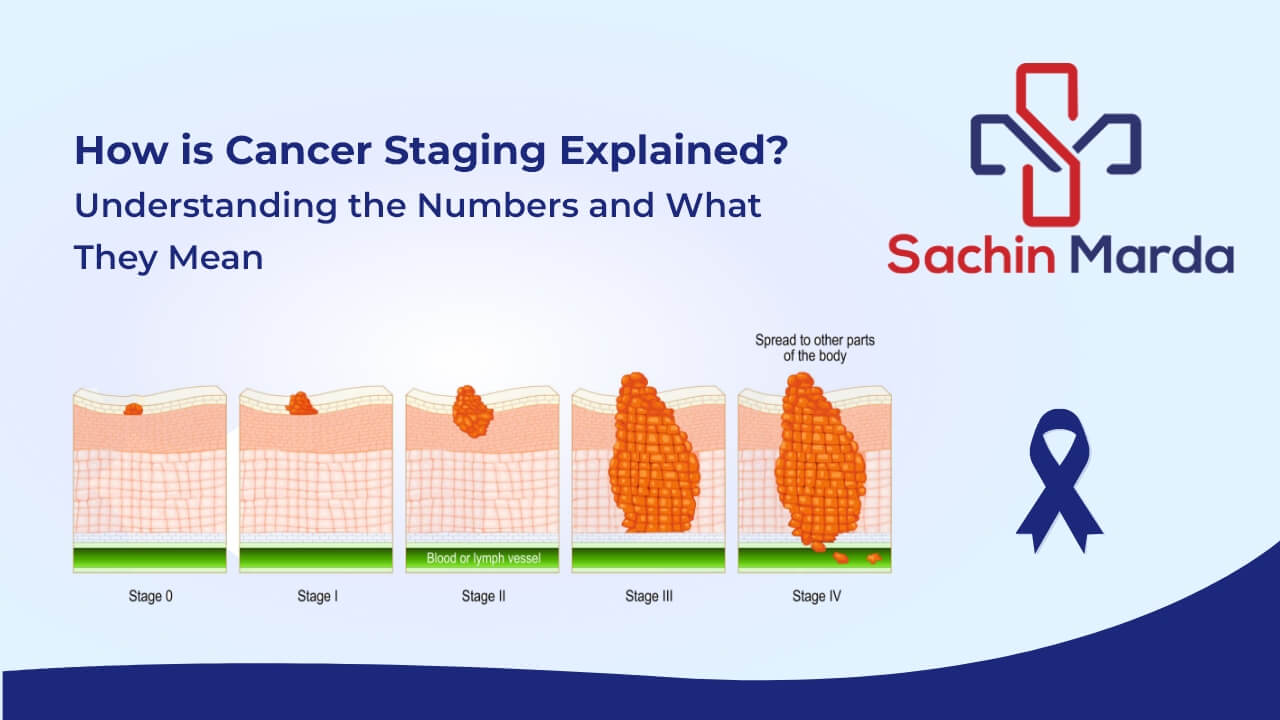 Cancer Stages Explained: The 0-IV Guide