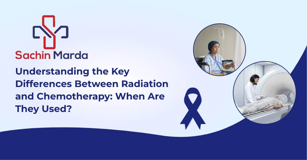 Chemo or Radiation? When Each Treatment Is Used