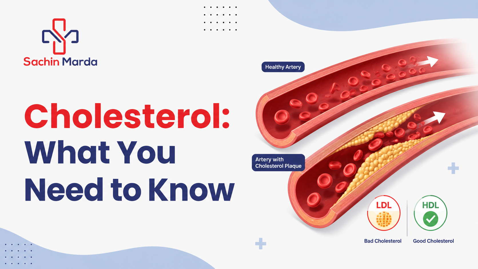Cholesterol: What You Need to Know